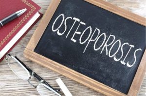 Cómo Afrontar La Osteoporosis Gracias A La Actividad Física